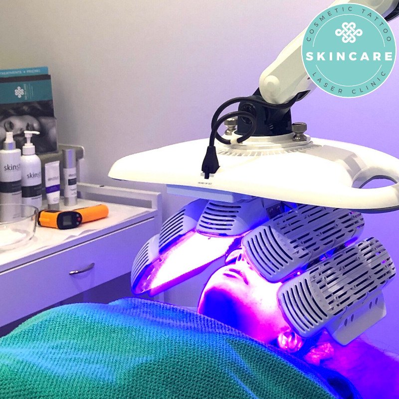 LED Light Therapy Treatment - Royal Wharf Clinic